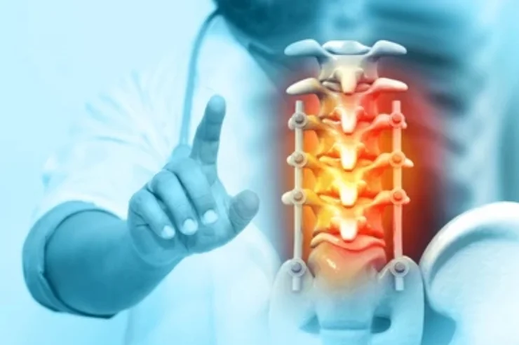 Spinal Stenosis Treatment